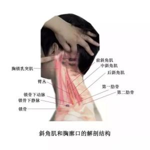 胸锁乳突肌