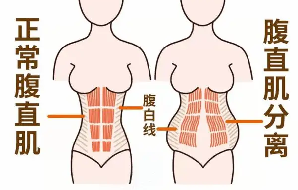 腹直肌