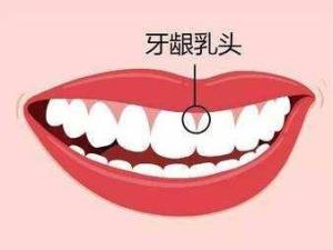 牙龈
