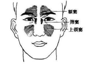上颌窦