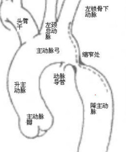 头臂干