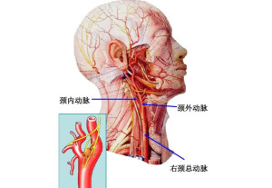 颈总动脉