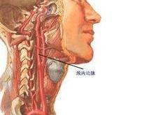 颈内动脉