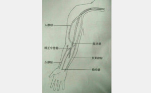 肱动脉