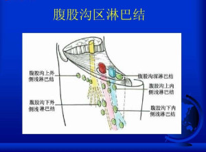 腹股沟淋巴结
