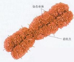 常染色体畸变