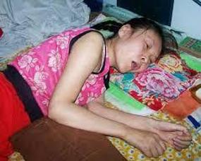 轻瘫