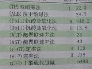 溶血性黄疸报告