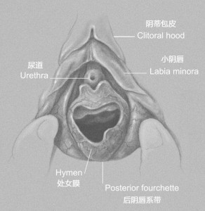处女膜示意图