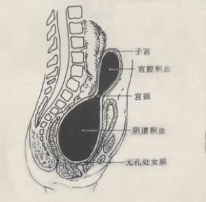 继发性闭经图册