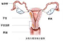 子宫出血