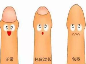 包皮粘连