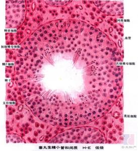 精子活力低