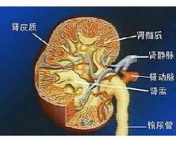 急性肾衰竭