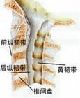 腰椎管狭窄