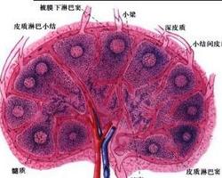 胃肠淋巴回流受阻