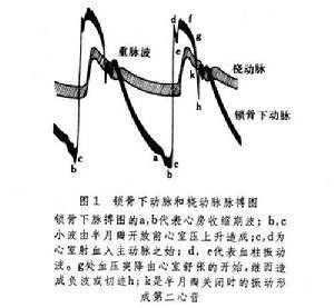 脉搏波的波形