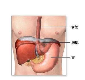 顽固性呃逆